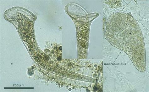  Heterotrichia! Descubra o Mundo Microscópico Deste Ciliophora com Uma Estrutura Única